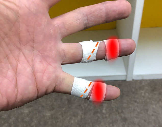 柔術テープ巻き方